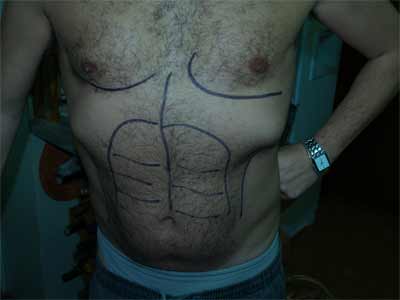 pectorales